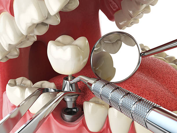 24-Hour Dental Clinic Near Me in NC